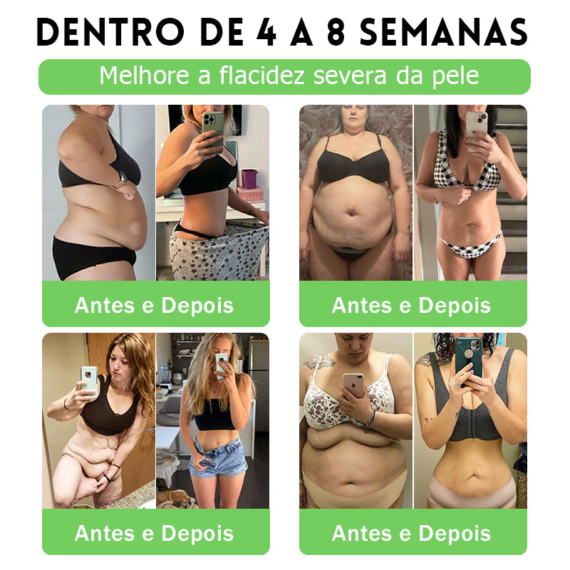 DOTALE® NAD+ Moringa Berberina AMPK | Adesivo Nano Microagulhas ✅ 1x/dia | Resultados visíveis em 7 dias