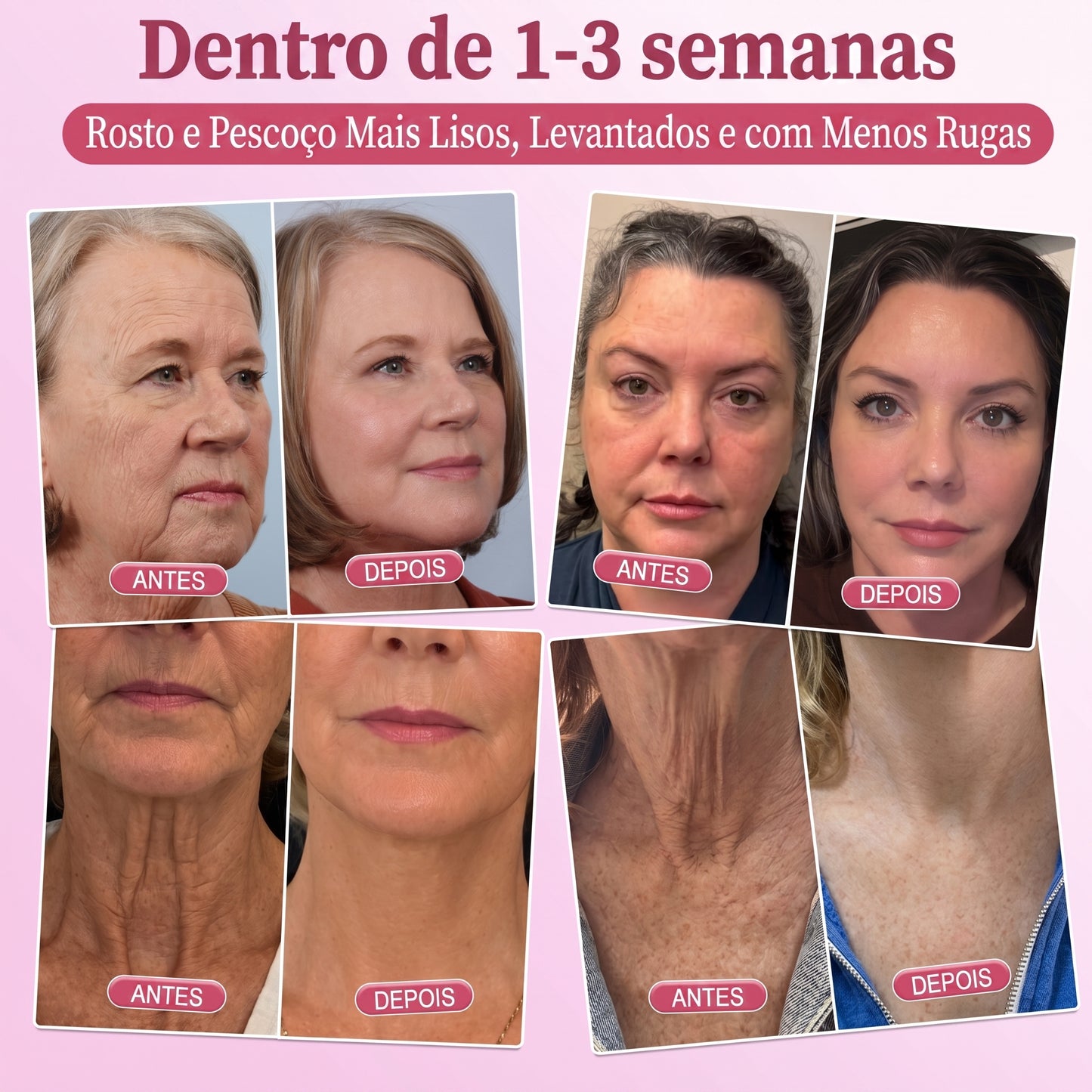 𝐇𝐈𝐒𝐊𝐈𝐍® 𝐏𝐃𝐑𝐍 𝐏𝐢𝐧𝐤 𝐂𝐨𝐥𝐥𝐚𝐠𝐞𝐧 𝐒𝐭𝐞𝐦𝐋𝐢𝐟𝐭 𝐏𝐥𝐮𝐦𝐩𝐢𝐧𝐠 𝐌𝐮𝐥𝐭𝐢 𝐁𝐚𝐥𝐦 𝐟𝐨𝐫 𝐔𝐧𝐝𝐞𝐫-𝐄𝐲𝐞𝐬, 𝐍𝐞𝐜𝐤, 𝐅𝐨𝐫𝐞𝐡𝐞𝐚𝐝, 𝐒𝐦𝐢𝐥𝐞 𝐋𝐢𝐧𝐞𝐬,𝐅𝐢𝐫𝐦𝐢𝐧𝐠, 𝐋𝐢𝐟𝐭𝐢𝐧𝐠, 𝐅𝐮𝐥𝐥𝐞𝐫-𝐋𝐨𝐨𝐤𝐢𝐧𝐠 𝐂𝐮𝐫𝐯𝐞𝐬 & 𝐒𝐤𝐢𝐧 𝐂𝐨𝐦𝐟𝐨𝐫𝐭