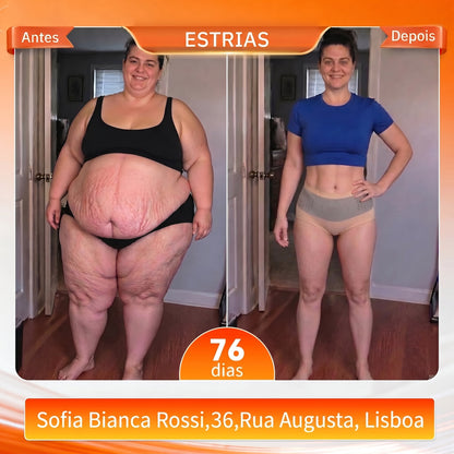 💎 Oferta Exclusiva de Upsell 30% de Desconto | KaaLa® Shorts Modellantes Queima Gordura 4-em-1 com Moringa e Berberina
