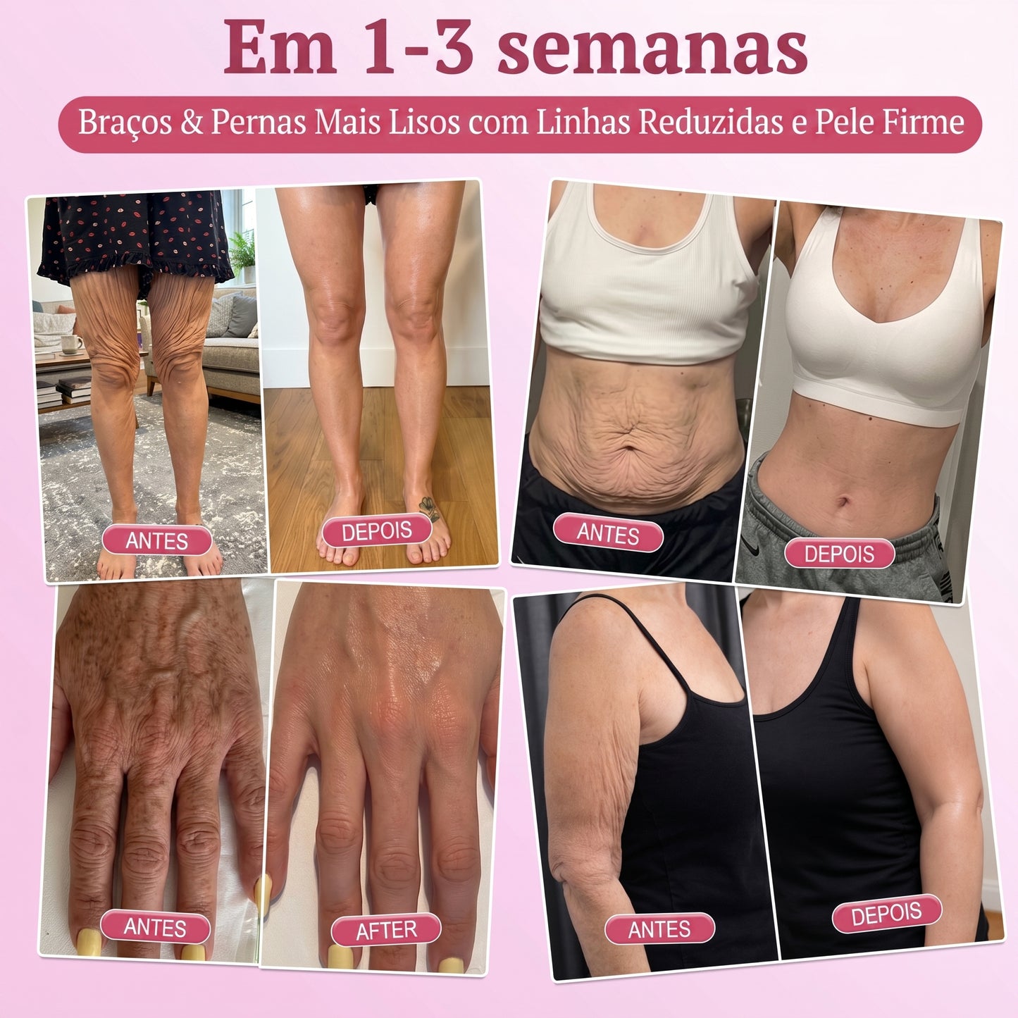 𝐇𝐈𝐒𝐊𝐈𝐍® 𝐏𝐃𝐑𝐍 𝐏𝐢𝐧𝐤 𝐂𝐨𝐥𝐥𝐚𝐠𝐞𝐧 𝐒𝐭𝐞𝐦𝐋𝐢𝐟𝐭 𝐏𝐥𝐮𝐦𝐩𝐢𝐧𝐠 𝐌𝐮𝐥𝐭𝐢 𝐁𝐚𝐥𝐦 𝐟𝐨𝐫 𝐔𝐧𝐝𝐞𝐫-𝐄𝐲𝐞𝐬, 𝐍𝐞𝐜𝐤, 𝐅𝐨𝐫𝐞𝐡𝐞𝐚𝐝, 𝐒𝐦𝐢𝐥𝐞 𝐋𝐢𝐧𝐞𝐬,𝐅𝐢𝐫𝐦𝐢𝐧𝐠, 𝐋𝐢𝐟𝐭𝐢𝐧𝐠, 𝐅𝐮𝐥𝐥𝐞𝐫-𝐋𝐨𝐨𝐤𝐢𝐧𝐠 𝐂𝐮𝐫𝐯𝐞𝐬 & 𝐒𝐤𝐢𝐧 𝐂𝐨𝐦𝐟𝐨𝐫𝐭