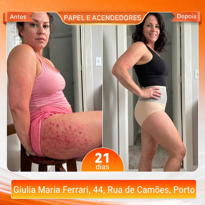 💎 Oferta Exclusiva de Upsell 30% de Desconto | KaaLa® Shorts Modellantes Queima Gordura 4-em-1 com Moringa e Berberina